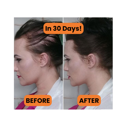 SERAVA - Pumpkin Seed Oil Capsules