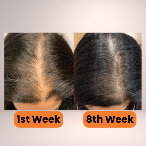 SERAVA - Pumpkin Seed Oil Capsules